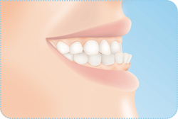 Bake Monetary presume anomalii ocluzale - Ortodontie, Stomatologie si Estetica DentaraCLINICA OMA  ORTODONTICA